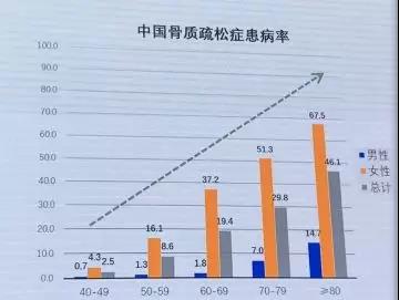 中国人骨密度从多少岁开始减少