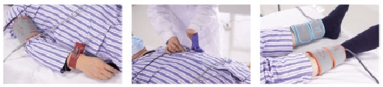 动脉硬化检测仪临床应用
